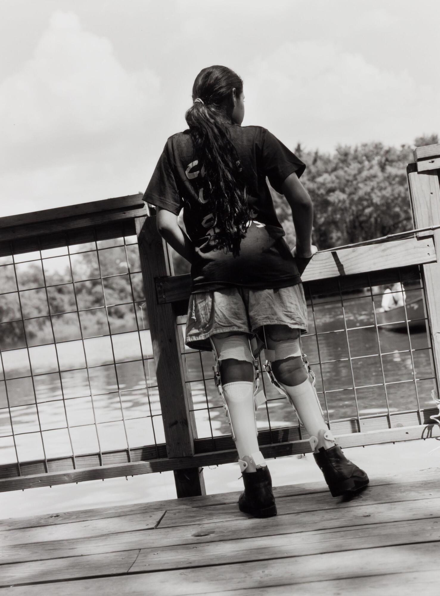 The back of a girl standing on a dock. She has a long ponytail and braces on her legs.
