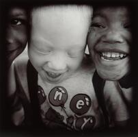 Three kids faces, the child in the center is albino.